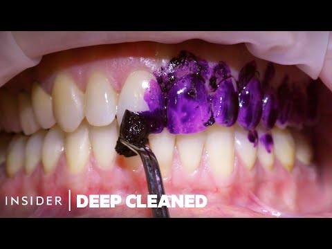 YouTube video about: What happens during a teeth cleaning?