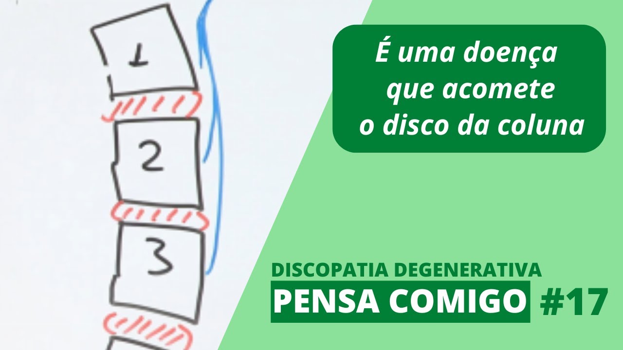 🤔 Pensa comigo 17 - O que é discopatia degenerativa