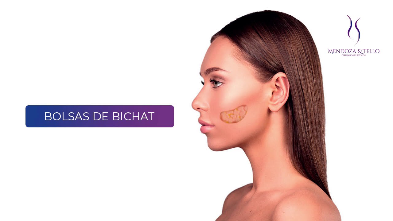 Alexander Mendoza-108