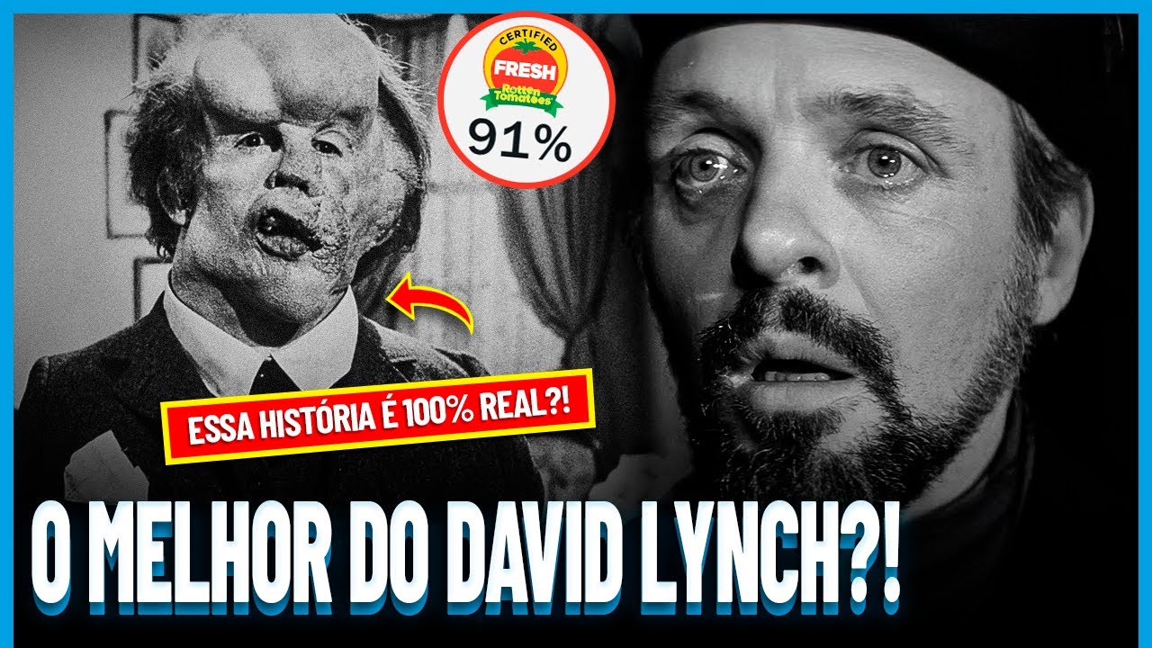 O Homem Elefante: um Caso Real BIZARRO que Virou um FILMAÇO | Filmes TOP #032