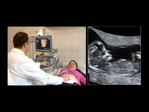 fogyni a test alakja alapján le zsírégető