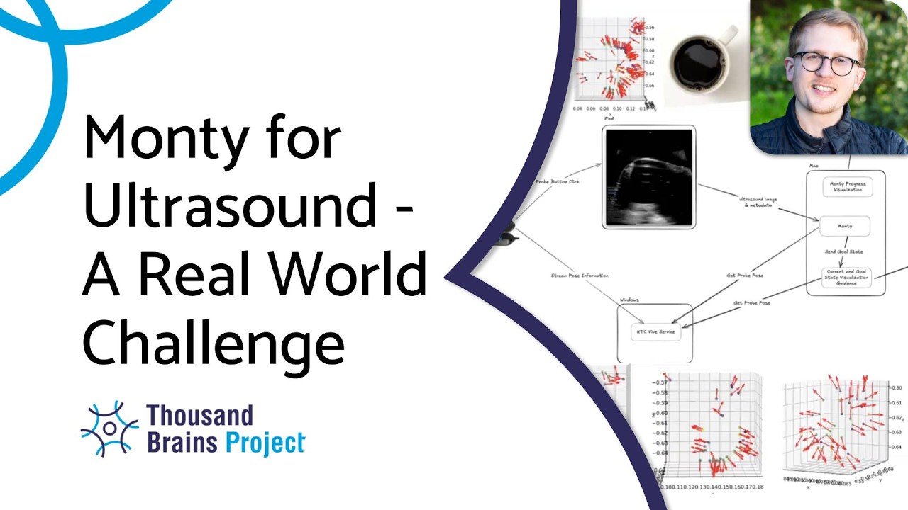 2026/04 - Monty for Ultrasound - A Real World Challenge