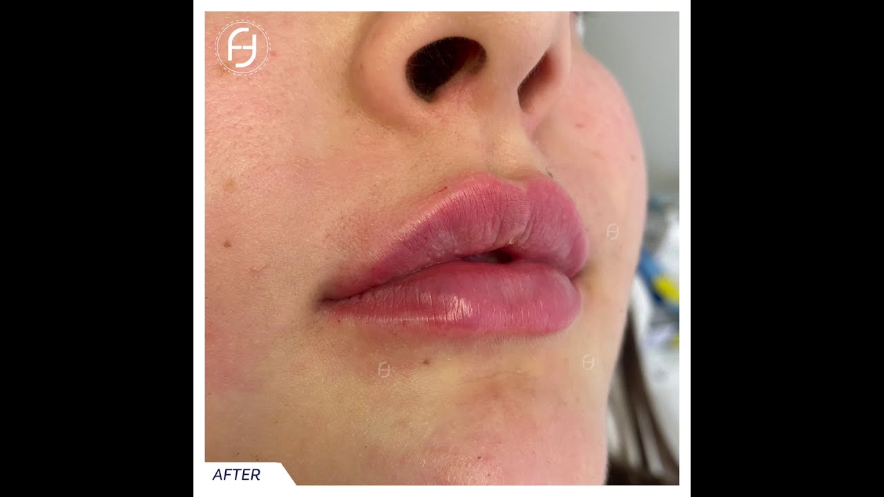 Francesca Flagiello-101