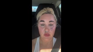 Download lagu Amanda Bynes reveals new cosmetic procedure mp3