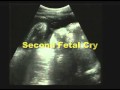 Discovery Channel Video Baby Cries in Womb.swf ...