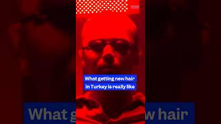 Here's what getting new #hair in #Turkey is really like. #hairtransplant