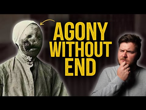 The Disturbing History of Leprosy