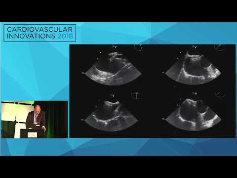 CVI2018 Session: There is more than one way to close a hole - Lee MacDonald, MD