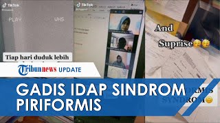 Viral Kisah Gadis Idap Sindrom Piriformis, Mengaku karena Sering Duduk hingga 15 Jam