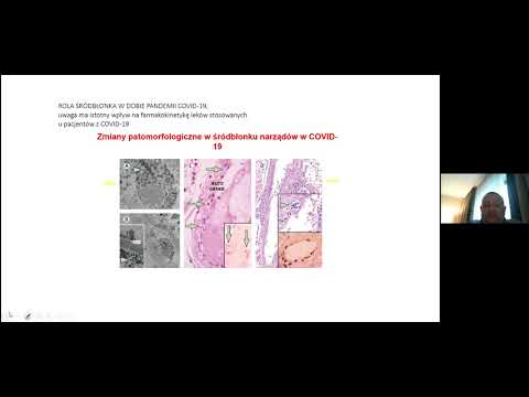 XXVIII Spotkanie Krakowskiej Grupy Wsparcia - film 1