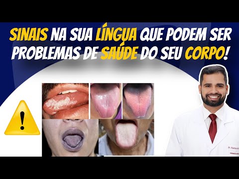 Francisco De Assis Almeida Lima Júnior-106