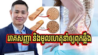 ជំងឺពុកឆ្អឹង | រោគសញ្ញា និងមូលហេតុ | អ្នកណាខ្លះអាចប្រឈមនឹងពុកឆ្អឹង |  លោក លី ប៉េង តែ Ly Peng Te