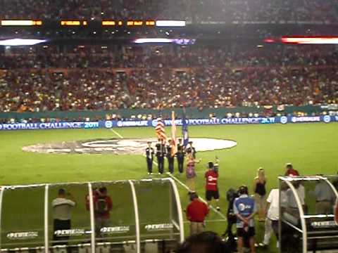 Partido Barça Miami