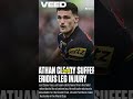 Nathan Cleary SERIOUS Lower Leg Compound Fracture #shorts #nrl