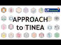 Approach to Tinea