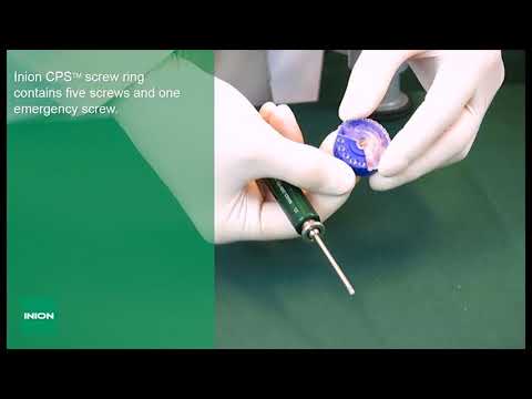 Inion CPS™ Tips and Tricks - Bioabsorbable Implants for Craniomaxillofacial Surgeries