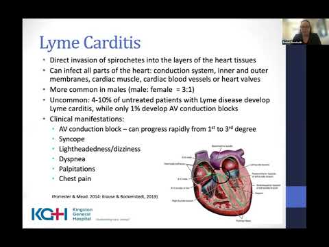 Lyme Carditis 2023 Update on Clinical Management (Dr. Rachel Wambolt)