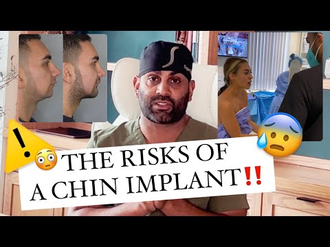 What are the RISKS of a chin implant!? *MUST WATCH BEFORE SURGERY*