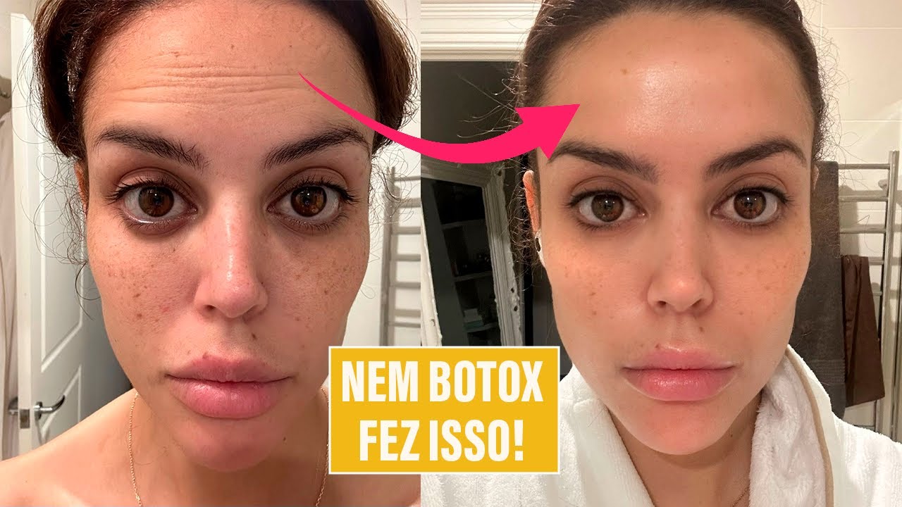 Rejuvenesci minha pele com produto de farmácia!