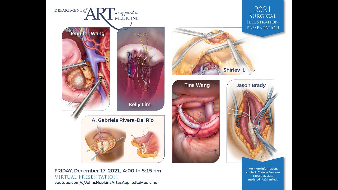 Surgical Illustration Presentation - MBI 2021