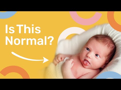 5 Worrying Things to Watch For During Development (And When You Need To Be Concerned)