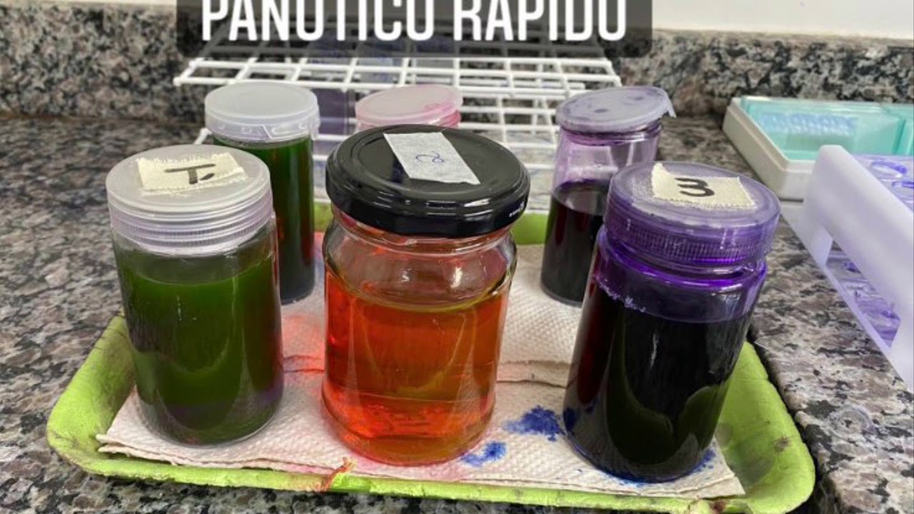 Esfregaço sanguíneo, Hematócrito e PPT