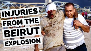 Beirut Explosion Victims: How to Stop Bleeding | Tourniquet Basics 1