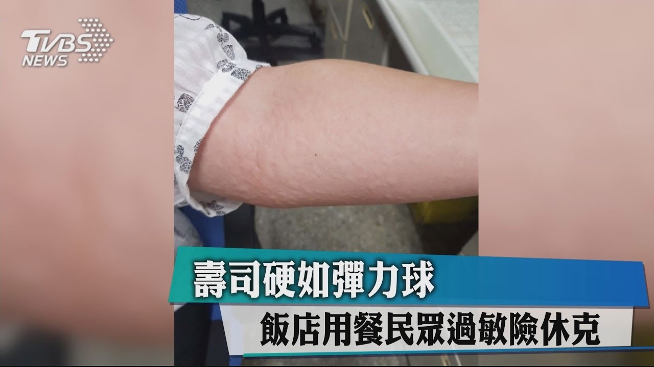 壽司硬如彈力球 飯店用餐民眾過敏險休克
