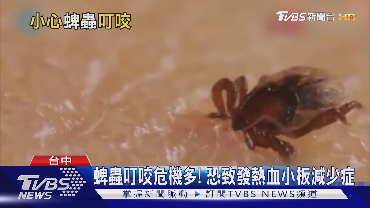 這款蟲愛注意!蜱蟲叮咬致傳染病 致死率竟達15%