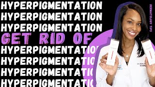 How to get rid of Hyperpigmentation, Dark Spots and Melasma