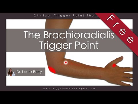 A brachialis artrózisa