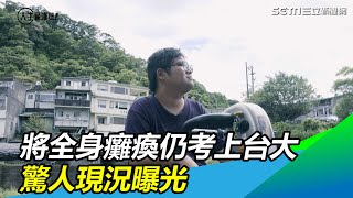 漸凍人「我很快會癱在床上」仍考上台大