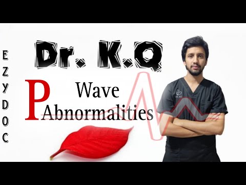 P wave Abnormalities |Absent P wave |Tall P wave on ECG|Dr K.Q