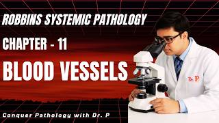 Diseases of Blood Vessels (FULL LECTURE) #robbins  #pathology