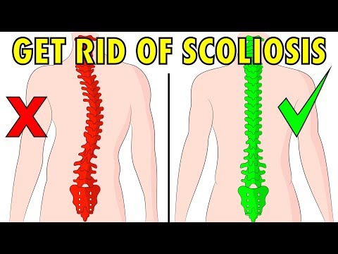 hipertónia scoliosissal normális pulzusszám