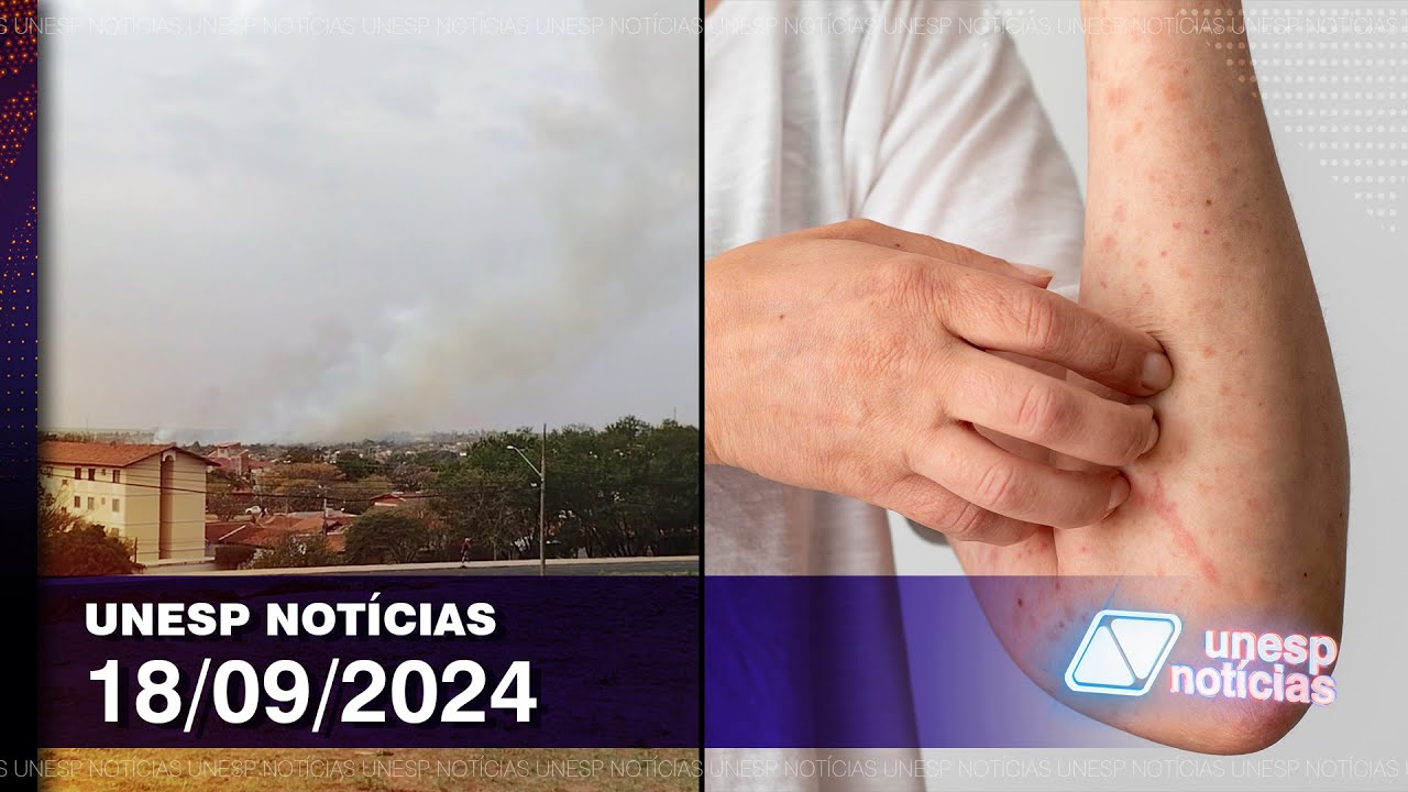 Como é medida a qualidade do ar, os riscos e a prevenção contra a Mpox #tvunesp