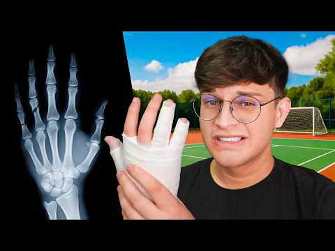 THE DAY I BROKE MY TWO FINGERS