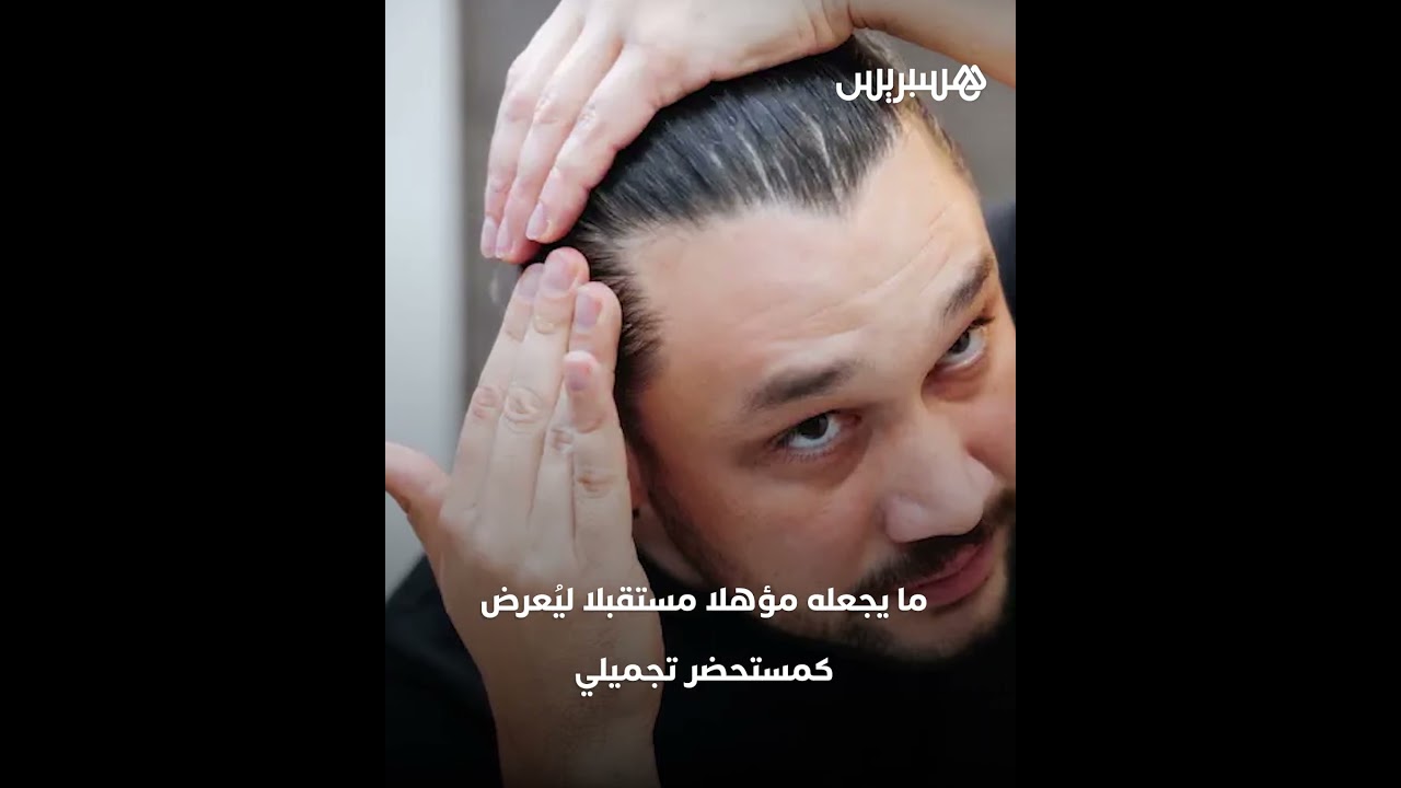 ابتكار مصل طبي من تايوان يُعيد إنبات الشعر خلال 20 يوما ويفتح الأمل لعلاج طبيعي للصلع thumbnail