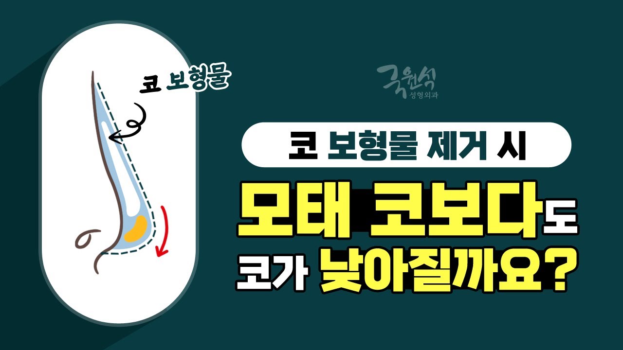 #코보형물제거 후, 코가 모태 코보다도 낮아지면 어쩌죠? 썸네일