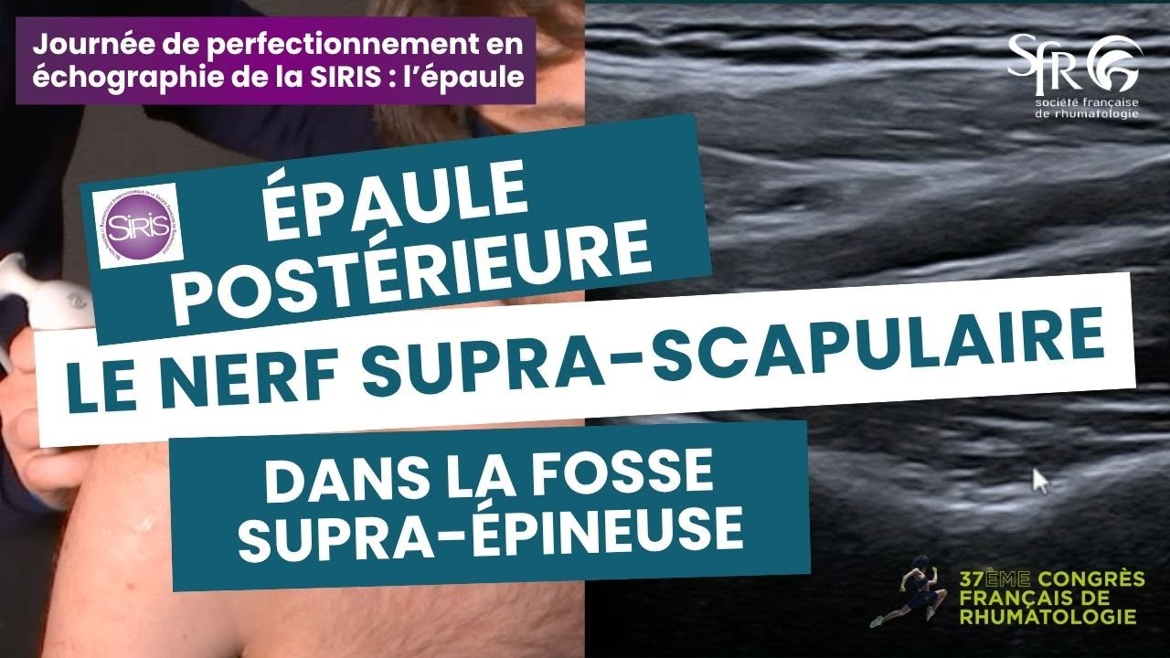 Journée de perfectionnement en échographie de la SIRIS