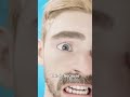 What To Do If You Re Stabbed In The Eye