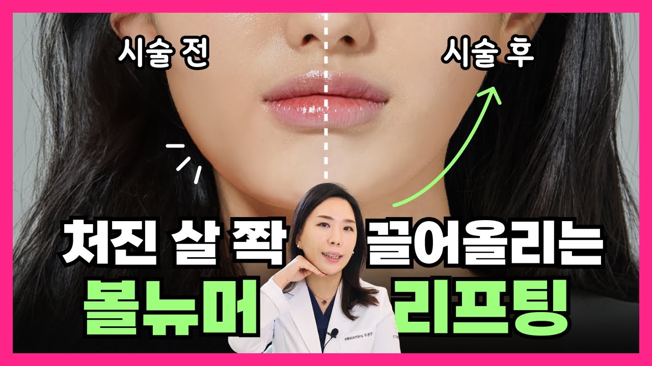 related_video_thumbnail
