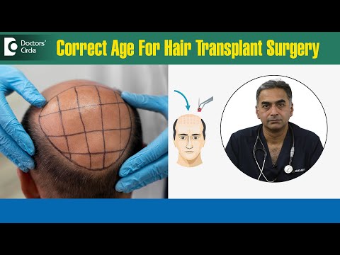BEST AGE for Hair Transplant | Am I Too Young for Hair...