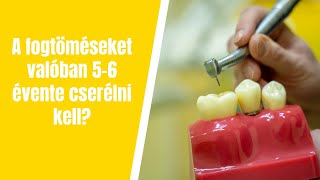 A fogtöméseket valóban 5-6 évente cserélni kell?