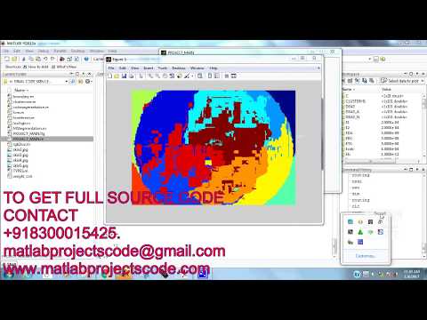 Automatic Skin Lesion Segmentation Using real-time image analysis system