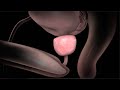 What is the Prostate Gland in Men?