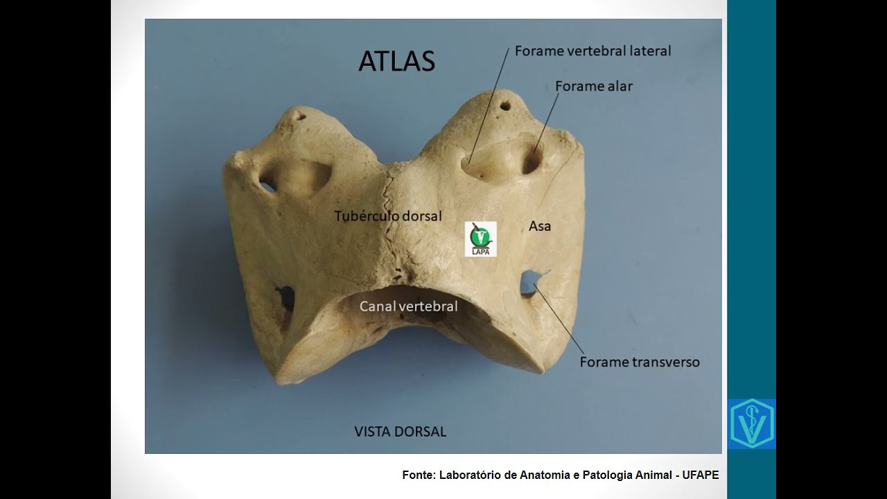 Osteologia Da Coluna Vertebral | Parte 01 | Atlas, Áxis e Vértebras Cervicais
