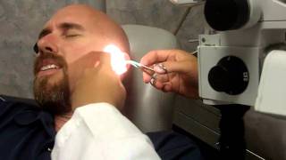 June Bug In My Ear Removal and Freak out! As seen on So You Think You&#39;d Survive