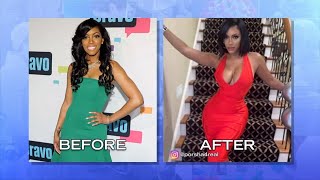 Real Housewives Before and After They Have Gone Under the Knife