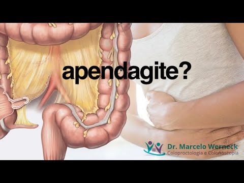 What is it? What is appendagitis?